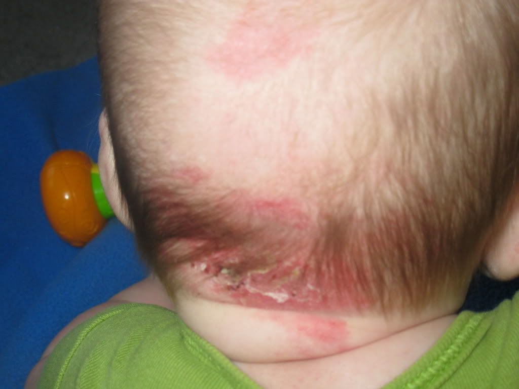 ot Has anyone seen this before? (baby related) BabyCenter